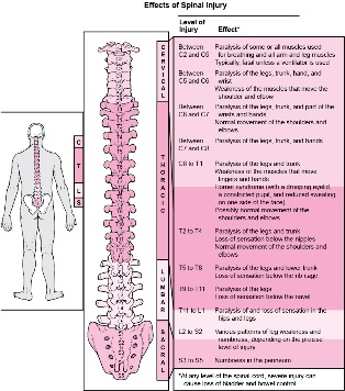 Maladies du corps associées à des dommages à diverses parties de la colonne vertébrale. 