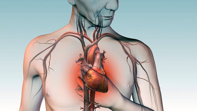 Douleur sous l'omoplate et douleur écrasante derrière le sternum avec une maladie cardiaque